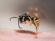 wasp sting